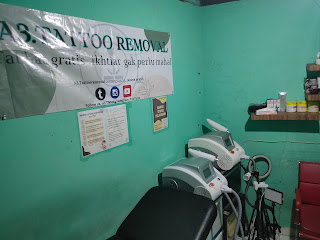 A3 tattoo removal / hapus tattoo jakarta