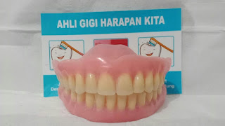 Ahli Pasang Gigi Harapan Kita