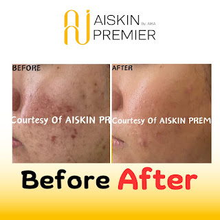 AISKIN PREMIER PONDOK INDAH