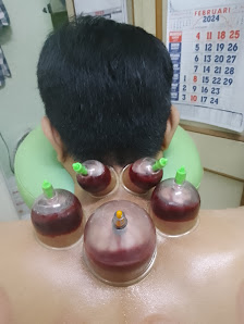 Bekam Sehat (TikSar),Pijat Refleksi, massage full body,Fashdu. Terima Panggilan.