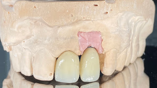 Dokter Gigi Surabaya - KAMA Dental Care