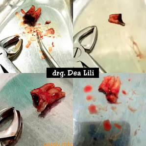 Drg. Dea Lili Anis Nur Pratama