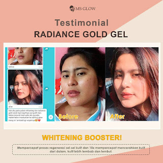 Facial treatment perawatan wajah