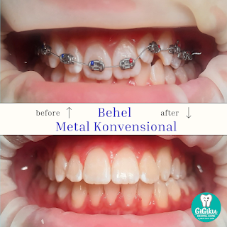 Gigiku dental care