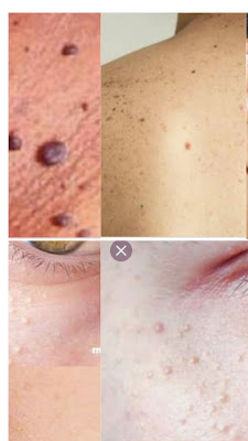 Humaira Get Beauty Salon Skin Care