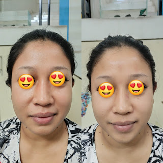 Inner Beauty Grace- Perawatan Wajah/ Facial & Kecantikan