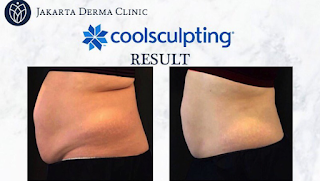 Jakarta Derma Clinic