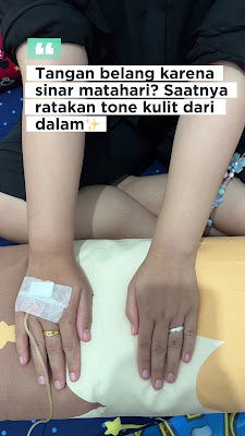 Jasa suntik putih jakarta
