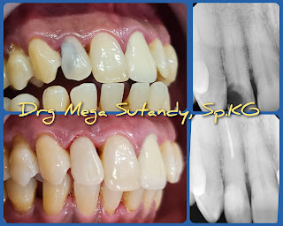 MEGA DENTAL