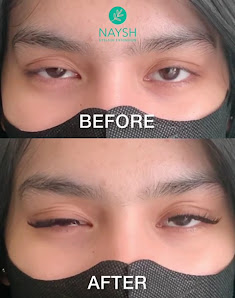 NAYSH Eyelash Extension & Lymphatic Massage Kemang