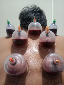 Pijat & Bekam panggilan Se-jabodetabek Terapis pria dan wanita profesional dan bersertifikat RBN Massage 3