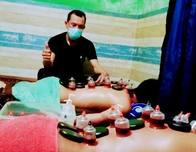 Pijat Refleksi Dan Bekam Sunnah