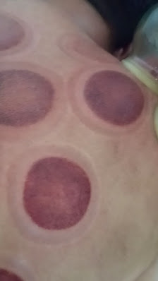 Pijat Reflexology9 and magneto therapy