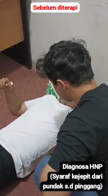Pijat Syaraf & Bekam Setiabudi Pesona Sehat