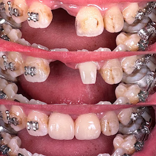 SHARFINA DENTAL CARE | DOKTER GIGI CIPADUNG
