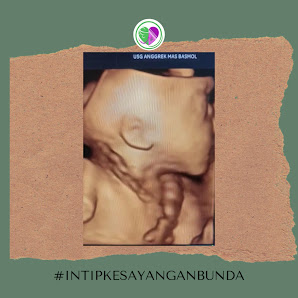 USG ANGGREK MAS BASMOL