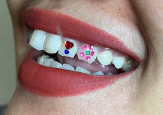 Zona Tooth Gems